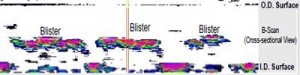 AUT B-Scan Slice revealing the presence of hydrogen blistering
