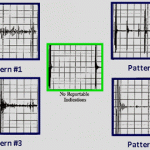 HTHA - Hydrogen Attack - HTHA Ultrasonic Backscattering Patterns